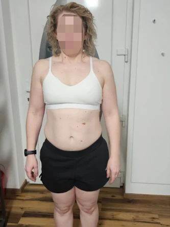 Vorher-Bild von Barbara