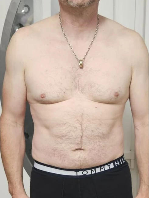 Nachher-Bild von Jürgen