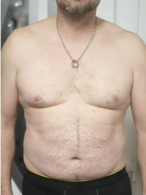 Vorher-Bild von Jürgen
